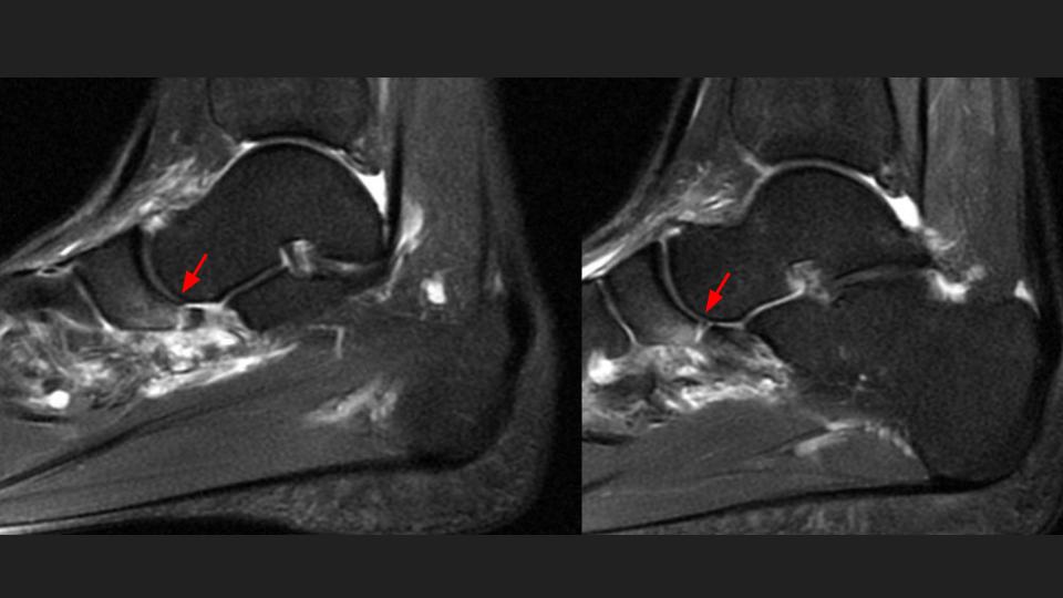 Figure 2 for case spring ligament ( RID3052 )